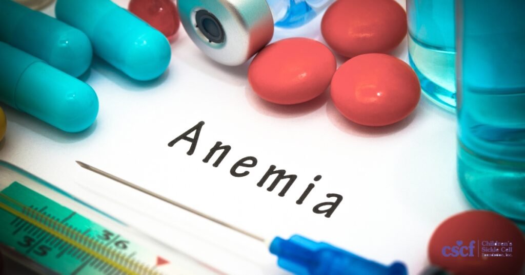 Sickle Cell Anemia